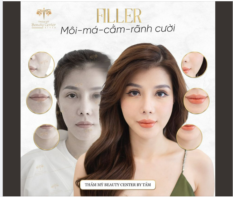 LỘT XÁC NGOẠN MỤC CÙNG COMBO FILLER TẠI TẤM