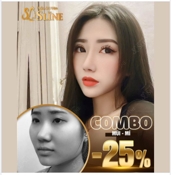 Lột xác Với combo mũi mí tại Thẩm Mỹ Viện Sline.