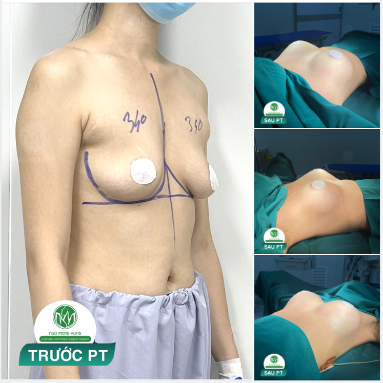 MẠNH DẠN THAY ĐỔI ĐỂ NHẬN ĐƯỢC KẾT QUẢ NHƯ Ý