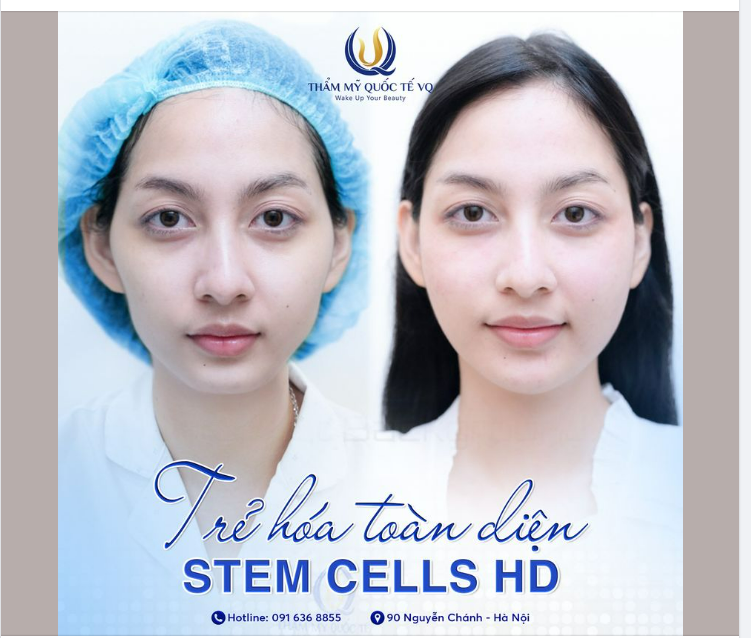 Mặt đẹp dáng thon Cùng Siêu trẻ hóa Stem Cells HD