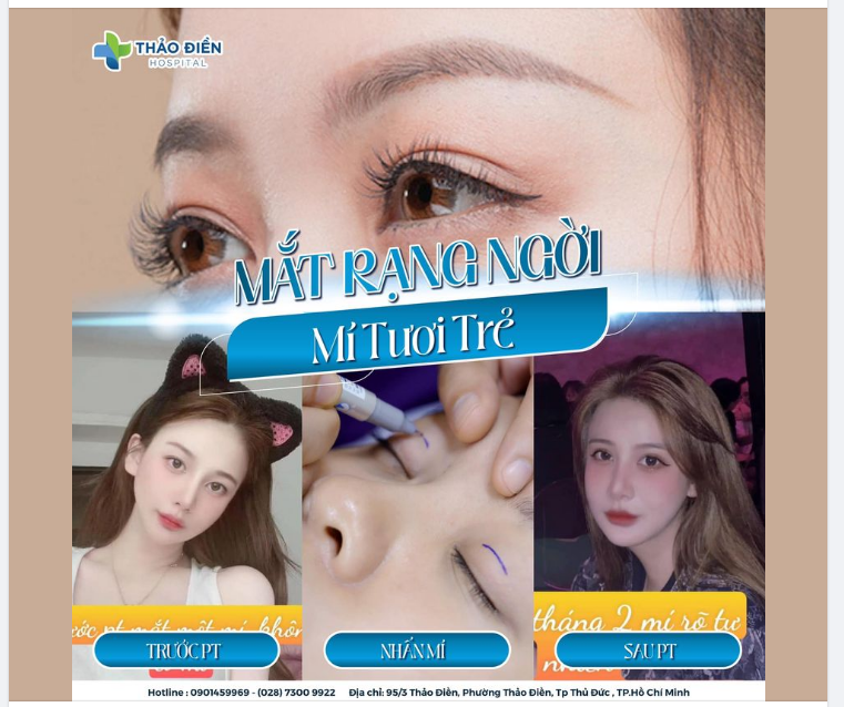 MẮT RẠNG NGỜI - MÍ TƯƠI TRẺ
