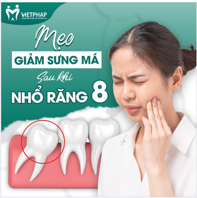 MẸO GIẢM SƯNG MÁ SAU KHI NHỔ RĂNG 8