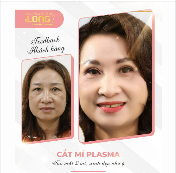 MÍ ĐẸP DỄ DÀNG - CHI PHÍ NHẸ NHÀNG - NÀNG MAU LÀM ĐẸP