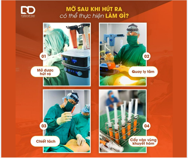 MỠ SAU KHI HÚT RA CÓ THỂ TẬN DỤNG KHÔNG
