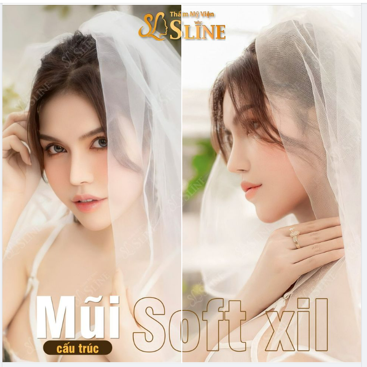 Một chiếc mũi xinh có làm bạn xao xuyến.