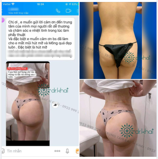 Một feedback NÂNG VÒNG 3 sau 2 tuần để thắp lên ngọn lửa làm đẹp cho chị em.