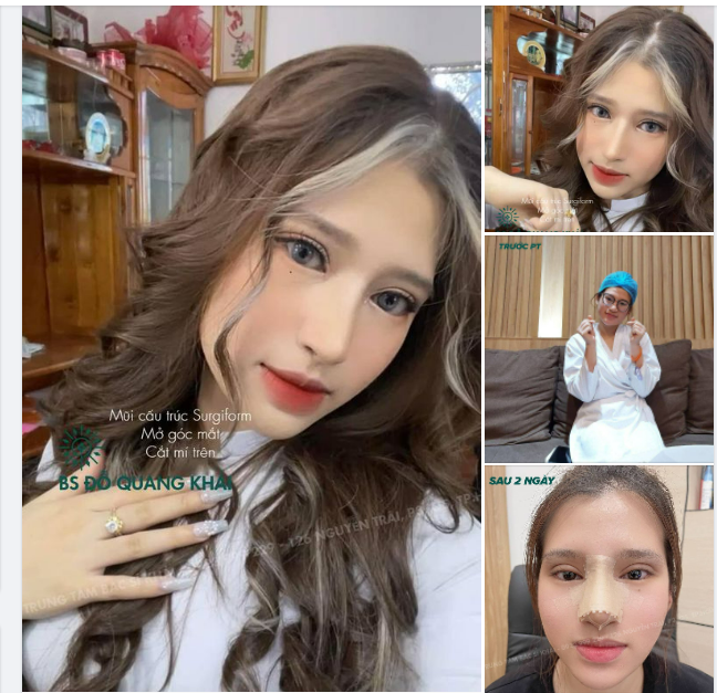 MỘT PHA BIẾN HÌNH CỦA KHÁCH HÀNG KHI LÀM ĐỦ COMBO TẠI TRUNG TÂM BS KHẢI.