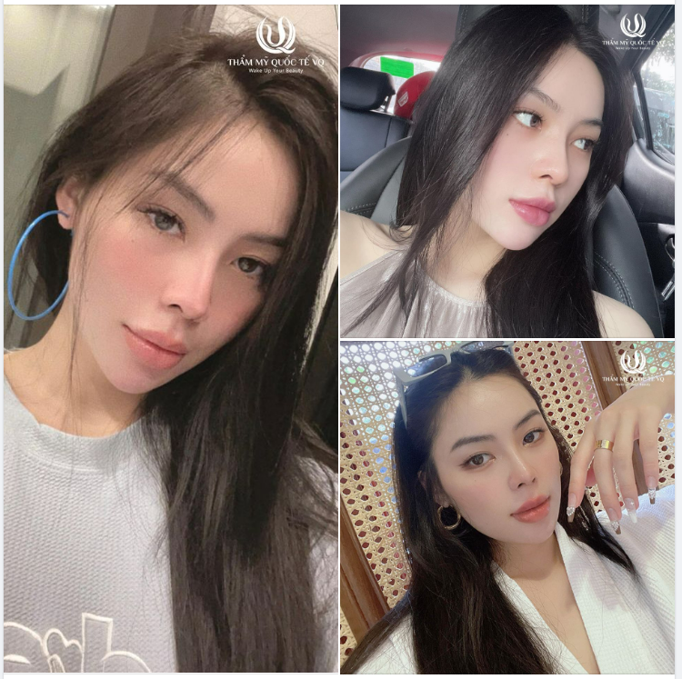 Mũi cao sang - Đời sang trang