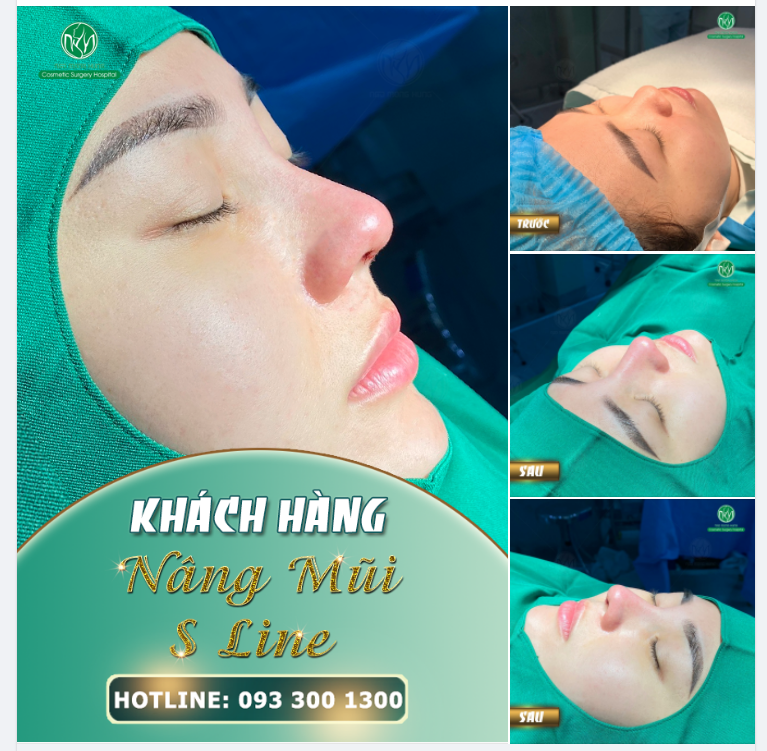 MŨI ĐẸP SÁNG CUỐI TUẦN