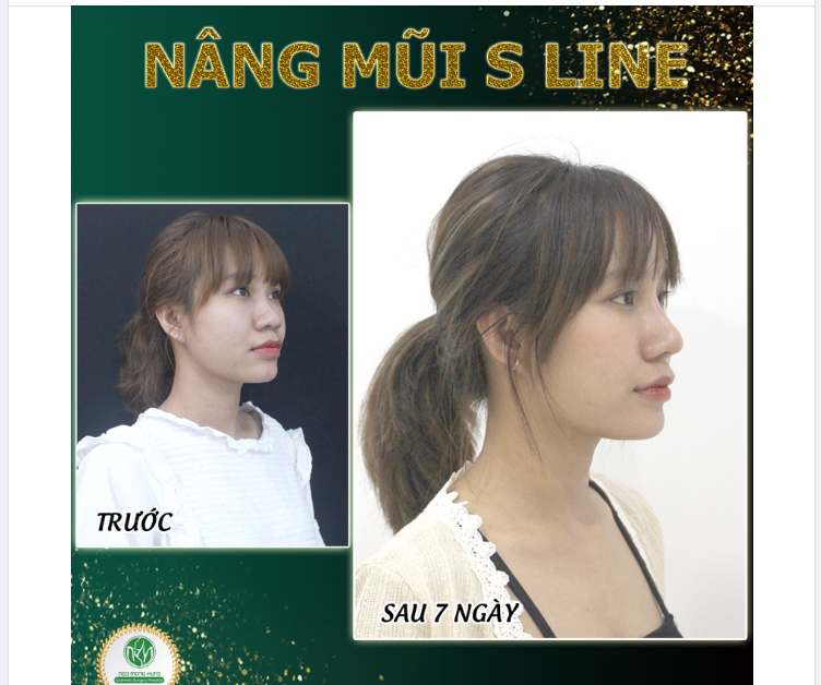 MŨI S LINE CAO SANG BẬT THẦN THÁI CHO KHÁCH HÀNG
