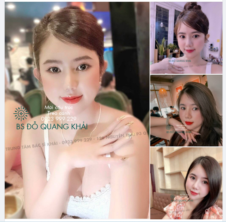 Mũi tự nhiên dịu dàng thế này các nàng có ưng