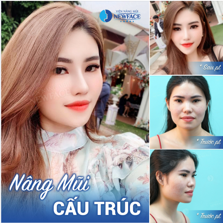 Muốn có gạo thì trồng lúa. Muốn đẹp như “công chúa” thì gặp bác sĩ Trần Phương…!