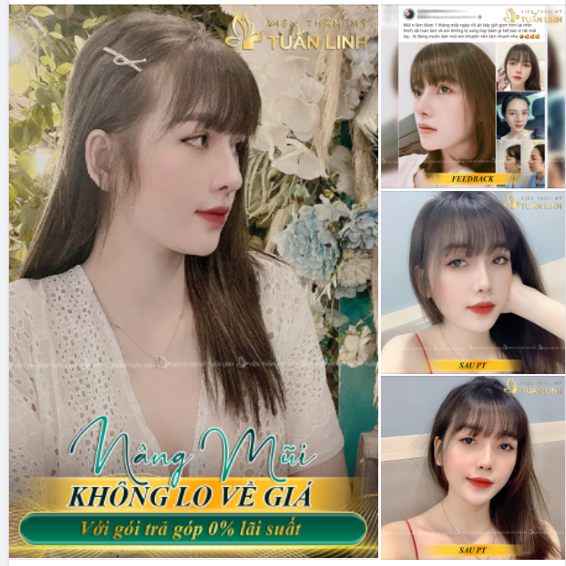 Muốn nâng mũi nhưng tài chính ''eo hẹp''...!!!