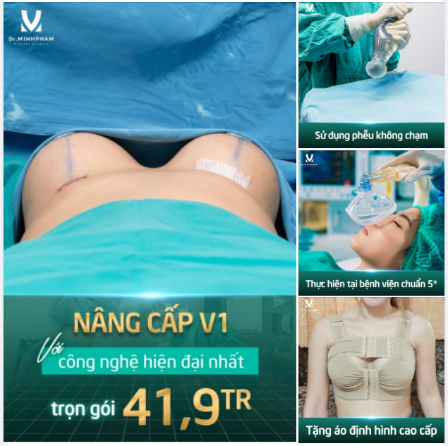 Nâng cấp V1 với công nghệ hiện đại nhất trọn gói chỉ 41,9 tr