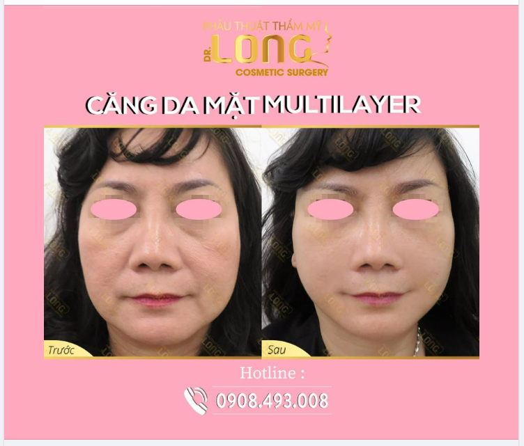 NÂNG CƠ TRẺ HÓA - XÓA MỌI NẾP NHĂN, ĐỪNG LĂN TĂN VÌ LÃO HÓA