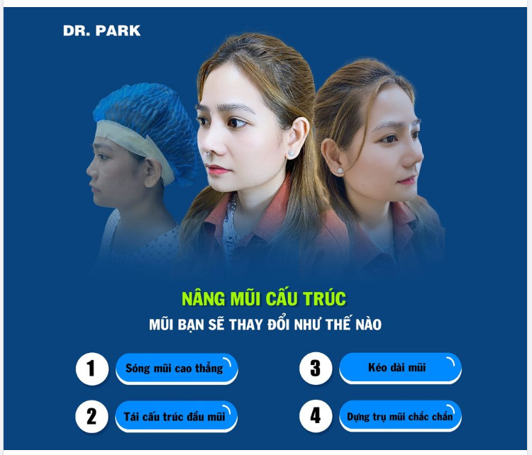 NÂNG MŨI CẤU TRÚC - MŨI BẠN THAY ĐỔI RA SAO