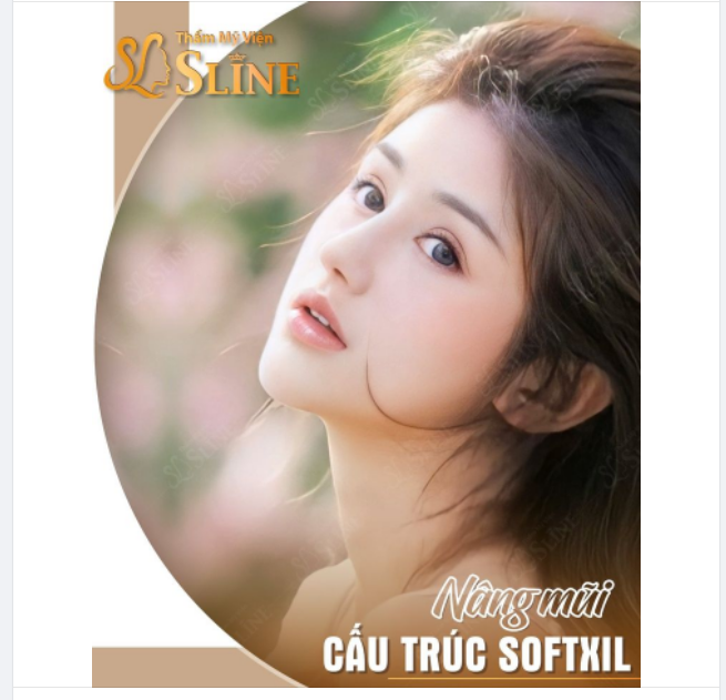 NÂNG MŨI CỰC XINHnLÊN HÌNH CỰC ĐỈNH