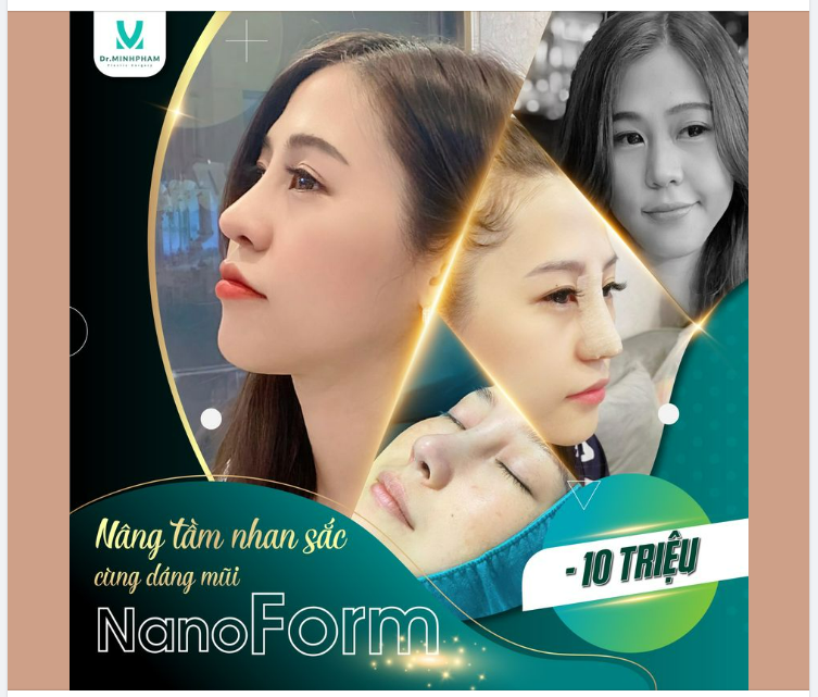 Nâng mũi Dr. Minh Phạm chưa bao giờ hết HOT
