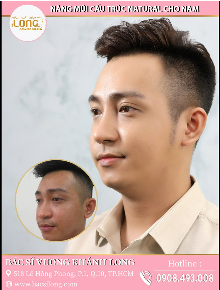 NÂNG MŨI LẬT SANG TRANG CUỘC ĐỜI, THỜI TỚI LUÔNNN