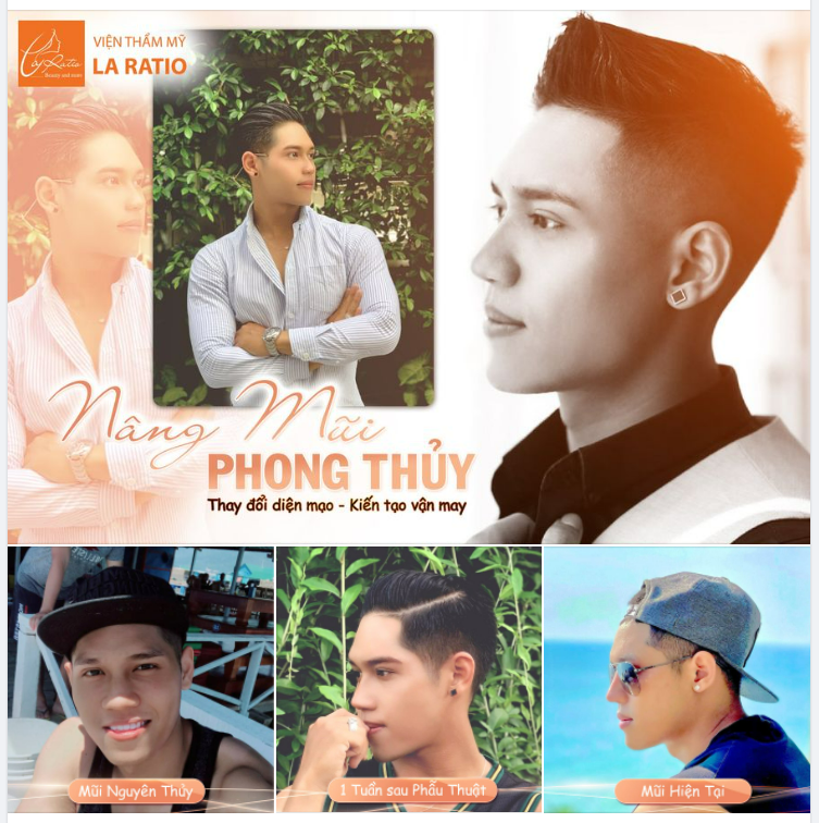 NÂNG MŨI NAM TƯỞNG KHÓ MÀ DỄ!!