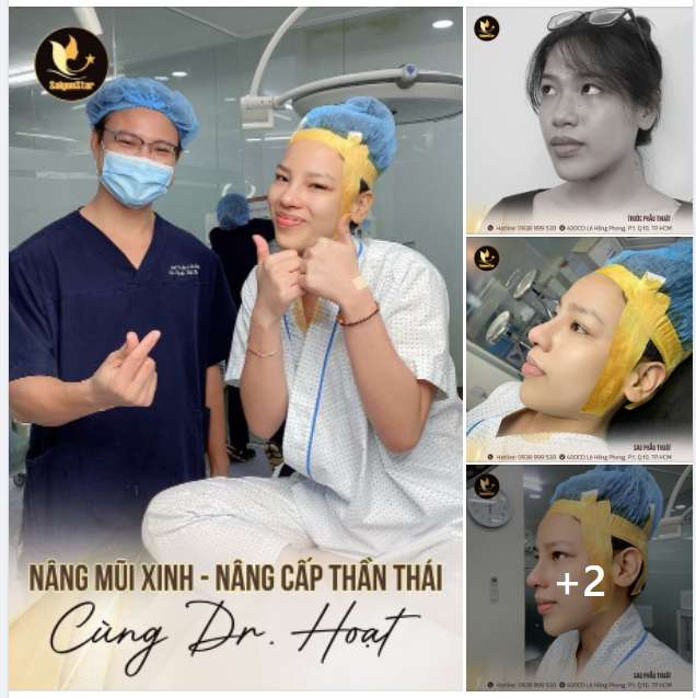 NÂNG MŨI XINH – NÂNG CẤP THẦN THÁI CÙNG DR HOẠT