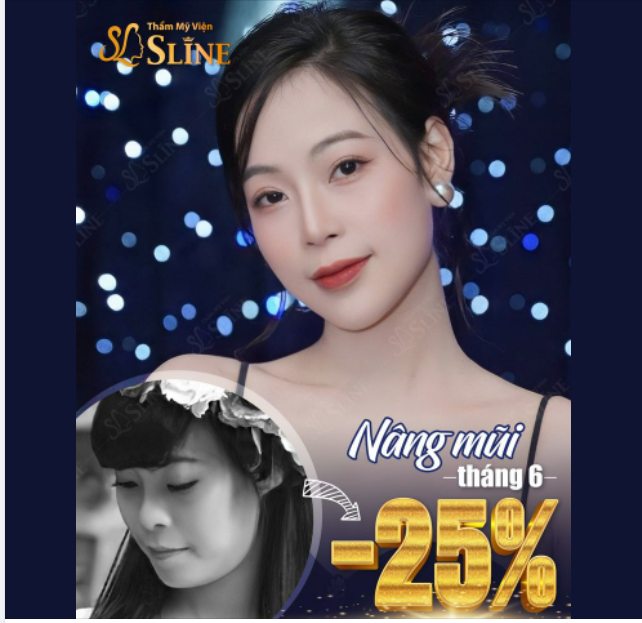 NÂNG MŨI....sẽ giúp khuôn mặt bạn trở nên cân đối và sang chảnh hơn.