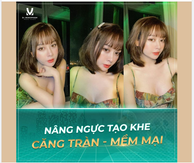 Nâng ngực tạo khe - Căng tràn mềm mại