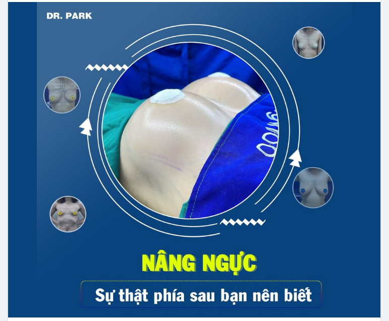 NÂNG NGỰC - SỰ THẬT PHÍA SAU BẠN NÊN BIẾT!!!