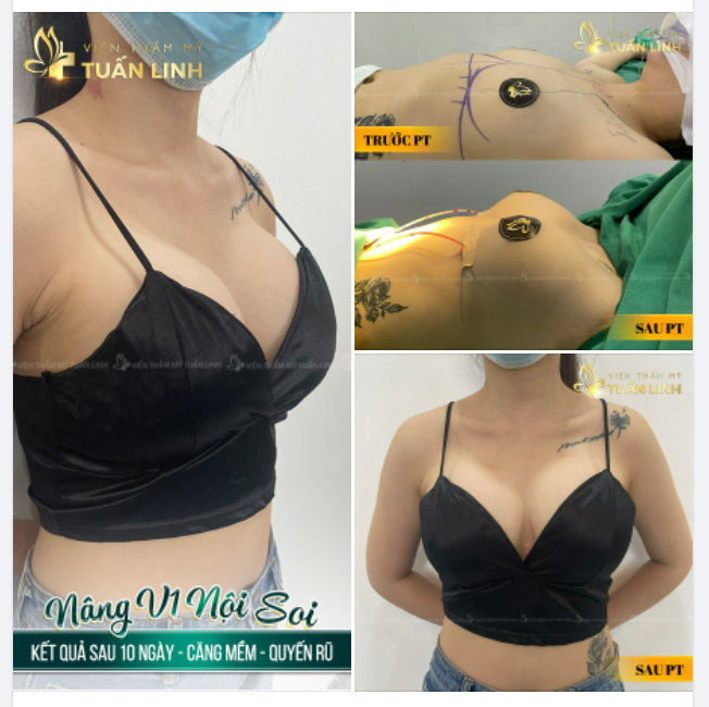 NÂNG V1 NỘI SOI - TẠM BIỆT V1 ''MÀN HÌNH PHẲNG'' CHỈ SAU 10 NGÀY