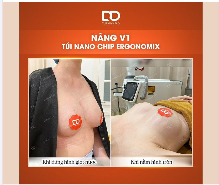 NÂNG V1 TÚI NANO CHIP ERGONOMIX LINH HOẠT MỌI TƯ THẾ