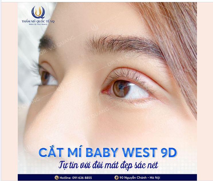 Nếp mí sắc nét - Mắt đẹp hút hồn​​​​​​​ Chỉ 8,6trieu