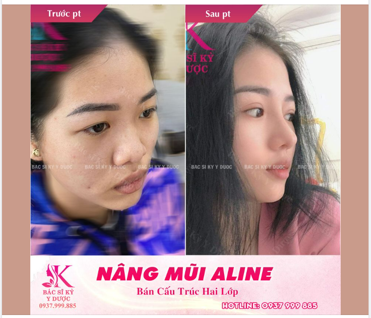 Nét đặc trưng của dáng mũi phong thủy là gì