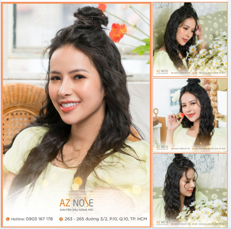 Nếu biết trước đẹp như vậy mình đã nâng mũi sớm hơn