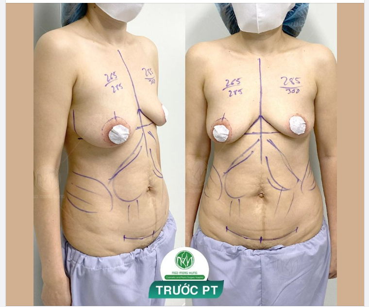 NGÀY ĐẦU TUẦN BẮT ĐẦU VỚI CA THẨM MỸ VÓC DÁNG