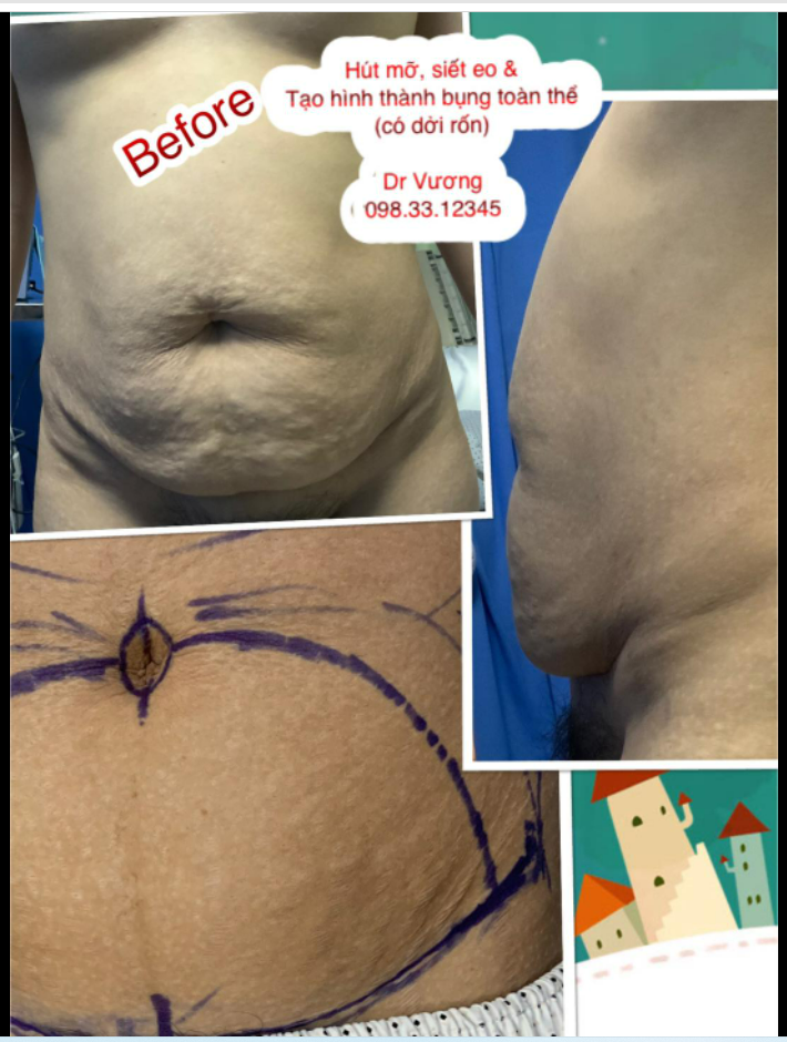 Ngày nghỉ (Chủ Nhật), bác sỹ vẫn tận tuỵ phục vụ sự nghiệp lấy lại vóc dáng sau sinh của bạn gái từ Quảng Ninh