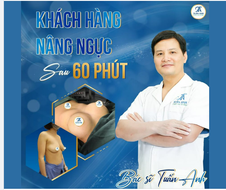 Ngực có tình trạng sa trễ thì có đặt túi độn như thế nào cho đẹp