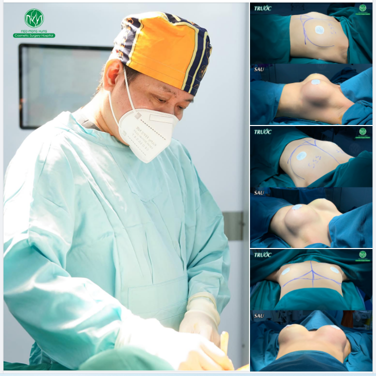 NGỰC NỘI SOI CHỈ 52TRIỆU CHỈ TRONG THÁNG 6 NÀY