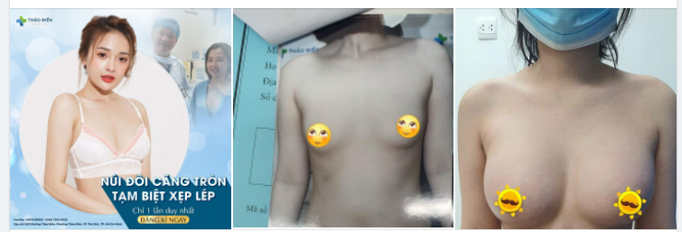 Người ta dính phốt yêu đương. Còn tui dính phốt thẩm mỹ đẹp quanh năm