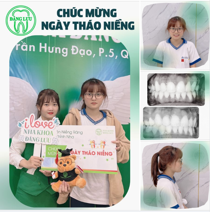 Nha Khoa Đăng Lưu chúc bạn Minh Thư sẽ luôn vui vẻ, tự tin chinh phục thành công mọi mục tiêu của cuộc đời mình bạn nhé!