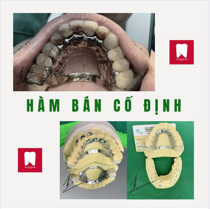 NHA KHOA NGỌC BÍCH LUÔN ĐƯA RA GIẢI PHÁP TOÀN DIỆN CHO BẠN 