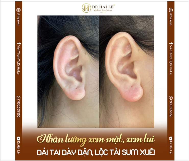 NHÂN TƯỚNG XEM MẶT XEM TAI DÁI TAI DÀY DẶN LỘC TÀI SUM XUÊ!