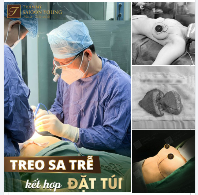 Nhiều chị em thời con gái may mắn sở hữu được V1 căng tròn tự nhiên.