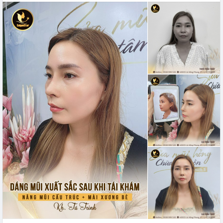 NHỜ CÓ NẮNG MỚI THẤY CẦU VỒNG NHỜ DR.HOẠT EM MỚI THẤY MÌNH XINH