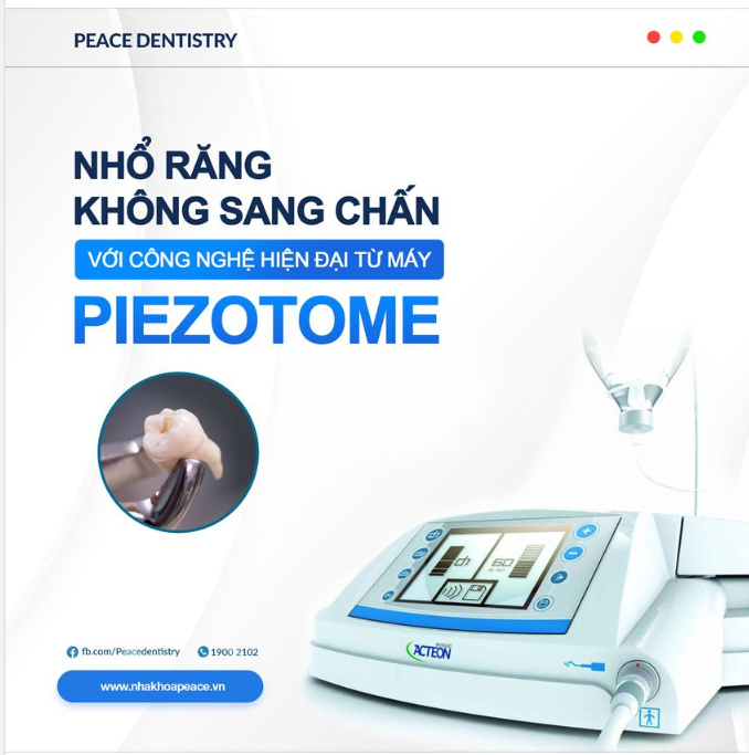 NHỔ RĂNG KHÔNG SANG CHẤN VỚI CÔNG NGHỆ HIỆN ĐẠI TỪ MÁY PIEZOTOME
