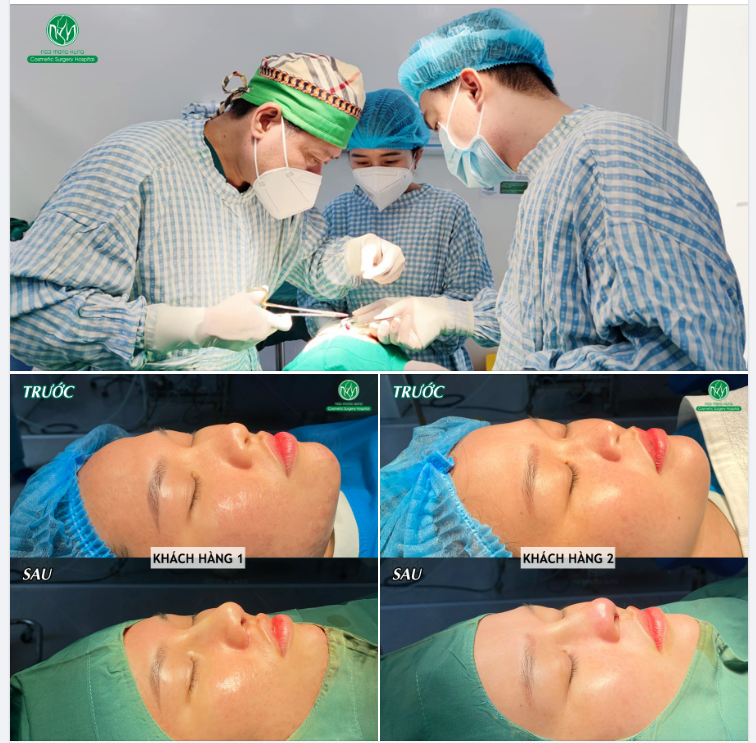NHỮNG CA NÂNG MŨI CUỐI NGÀY THỨ 5