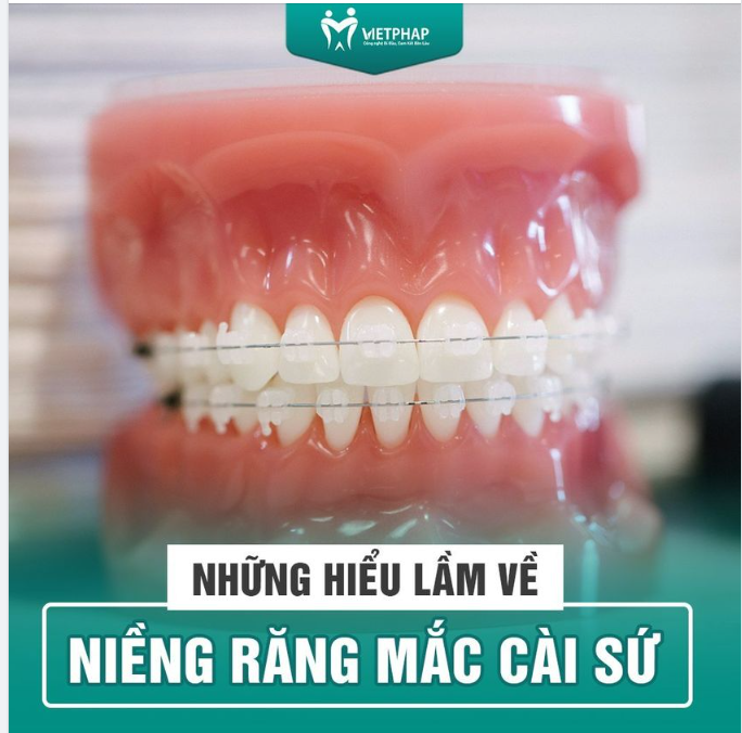 NHỮNG HIỂU LẦM VỀ NIỀNG RĂNG MẮC CÀI SỨ
