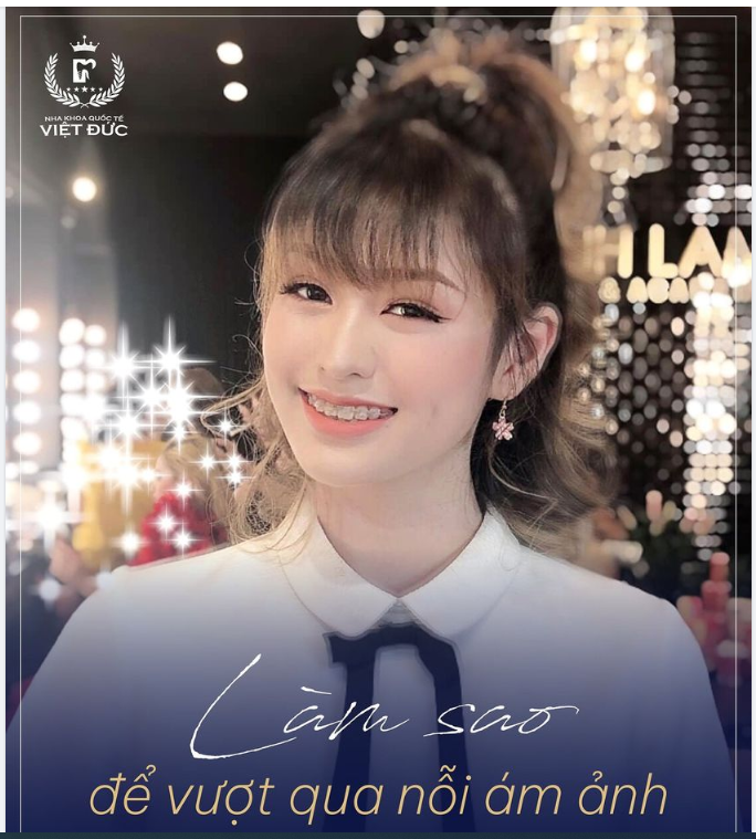 NIỀNG RĂNG HÓP MÁ PHẢI LÀM SAO?