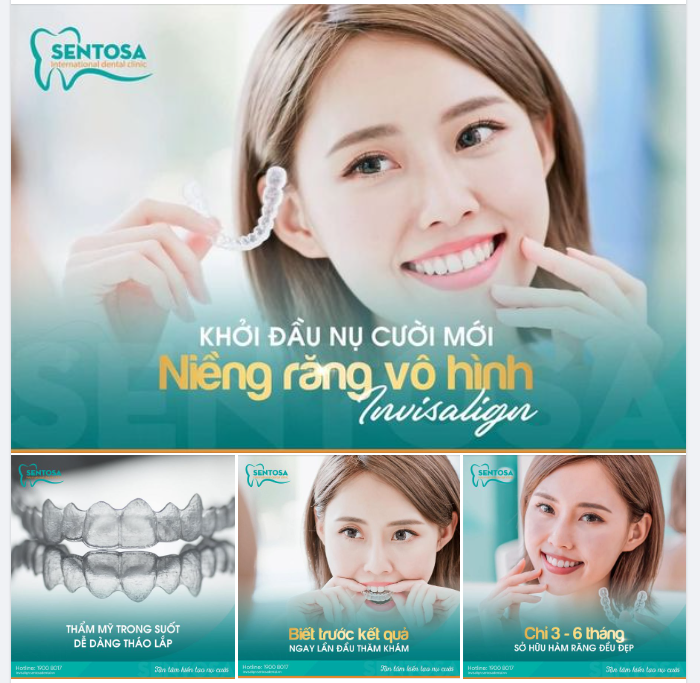 NIỀNG RĂNG INVISALIGN – TIỆN LỢI, THẨM MỸ NHANH, HIỆU QUẢ CAO