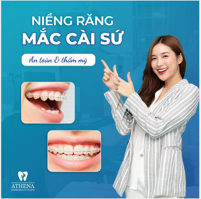 NIỀNG RĂNG MẮC CÀI SỨ -  AN TOÀN - THẨM MỸ