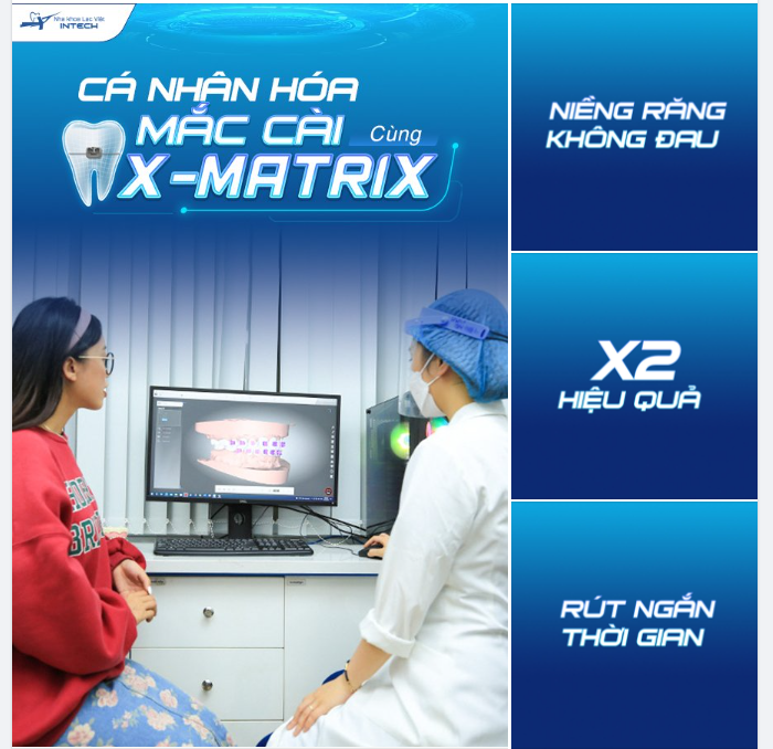 Niềng răng X-Matrix - Cá nhân hóa mắc cài, rút ngắn thời gian điều trị